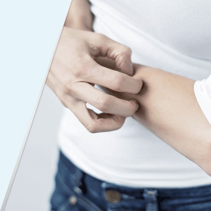 תסמינים של פטרת העור