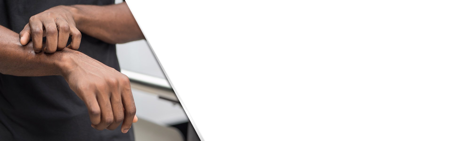 background-skin-fungus